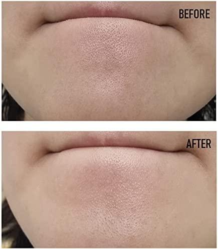 Mixsoon Bean Essence – Exfoliate, Hydrate, Glow