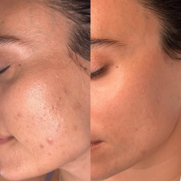 Mixsoon Bean Essence – Exfoliate, Hydrate, Glow